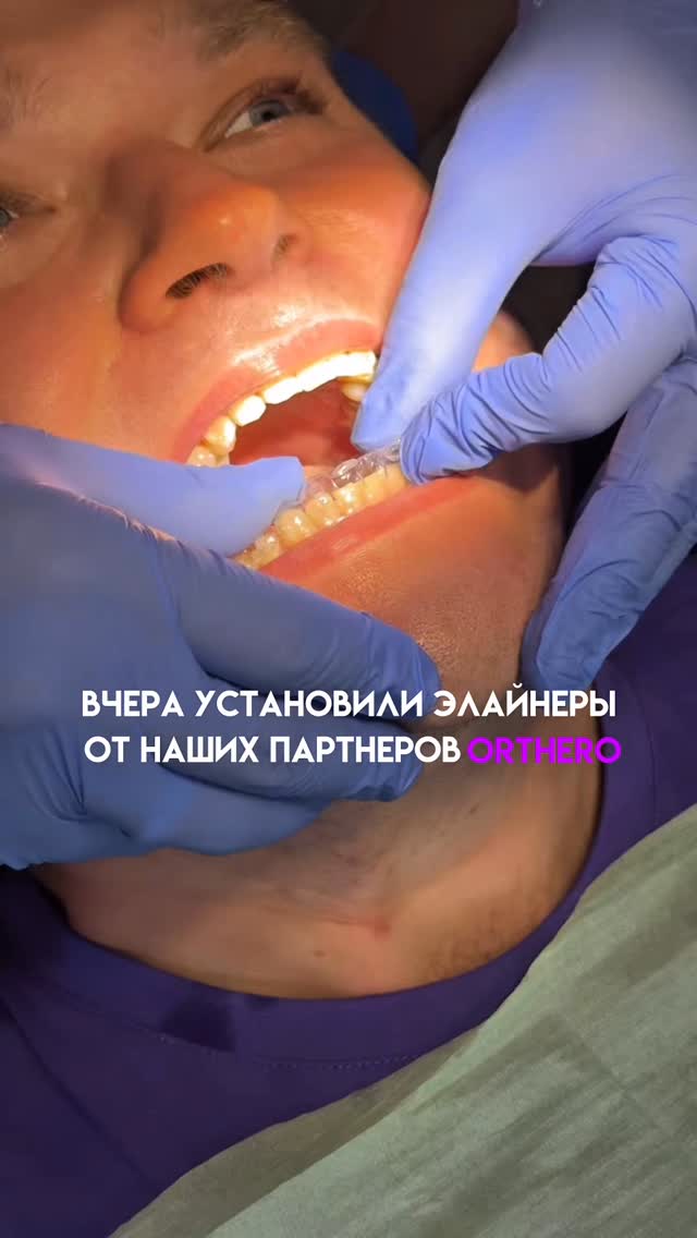 Элайнеры