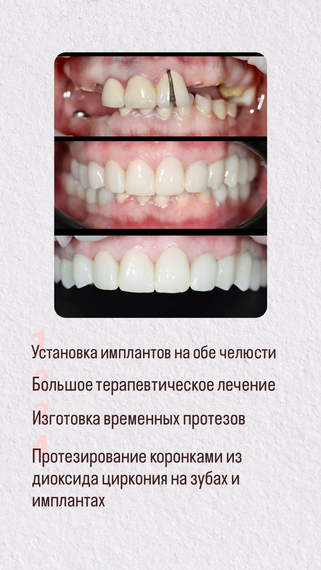 Детское лечение зубов