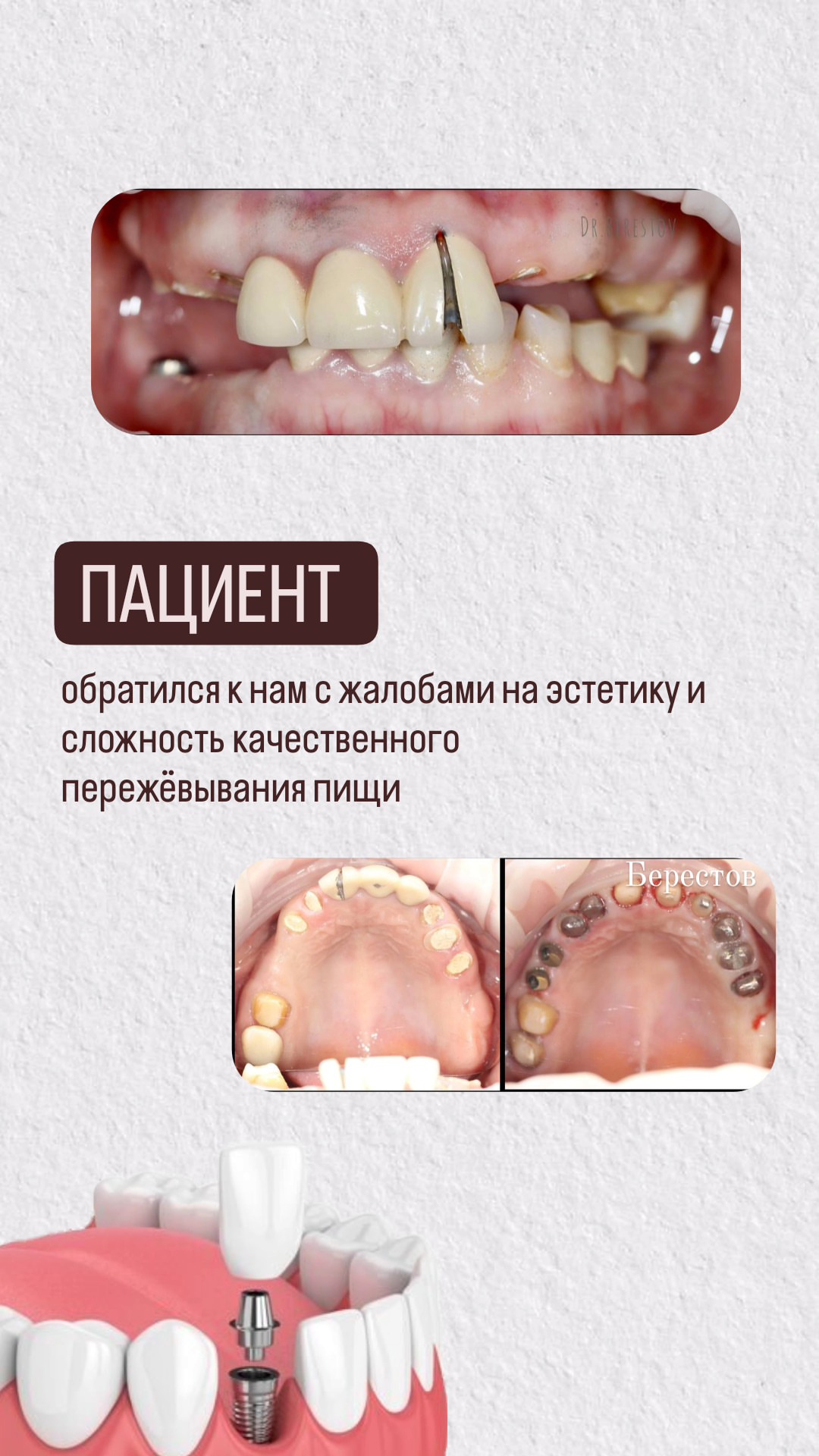 Эстетическая стоматология