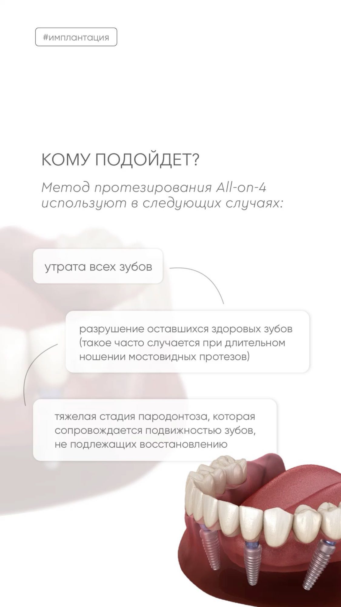 Имплантация с немедленной нагрузкой