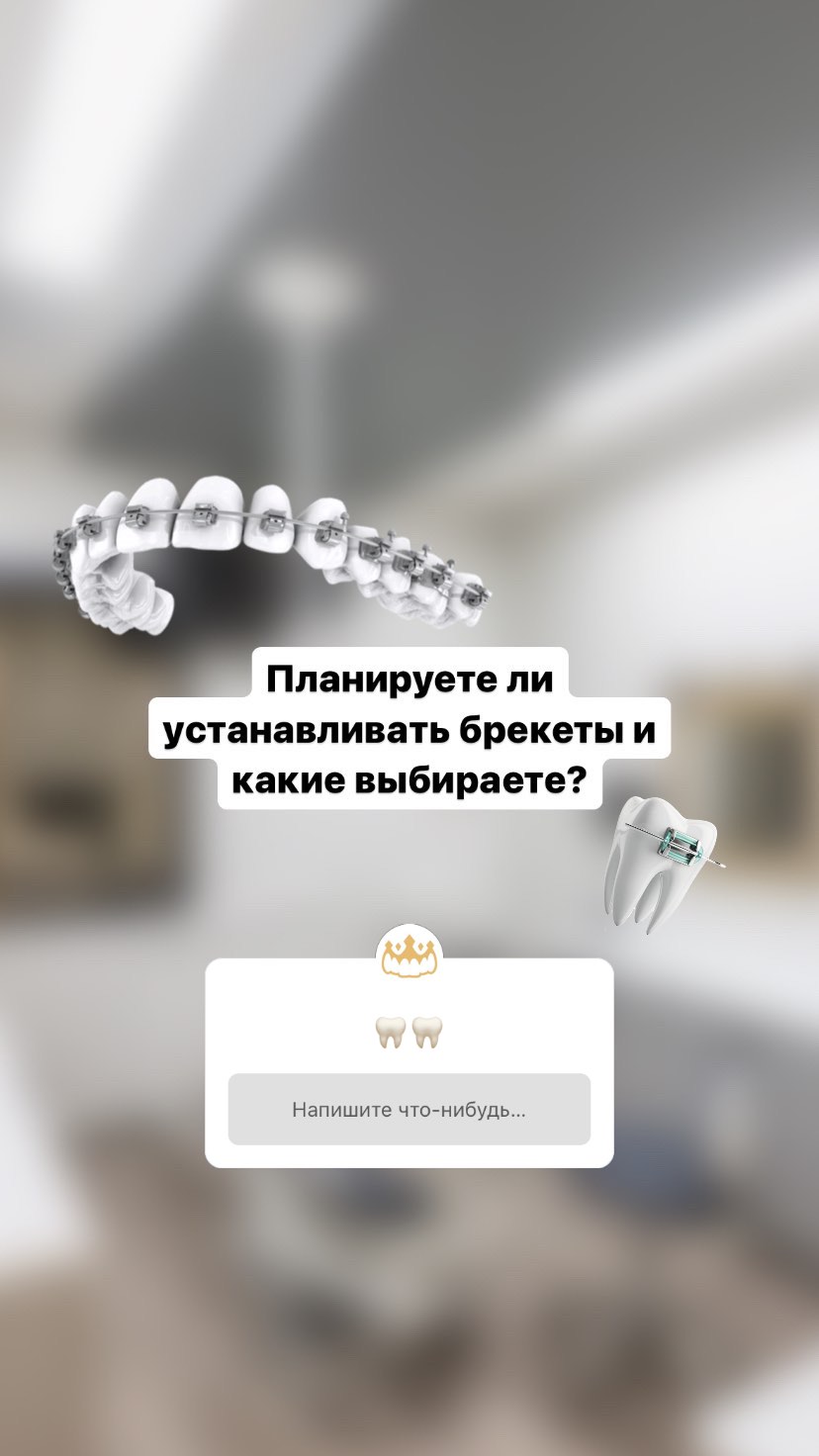 Брекеты